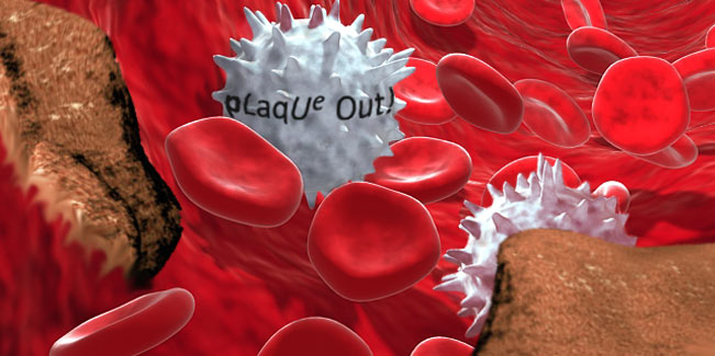Illustration of pLaqUe Out! cells among red blood cells in a vessel